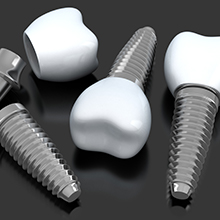 Animated implant supported crowns